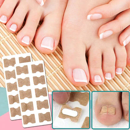 CORRECTOR UÑA ENCARNADA PEDICARE®