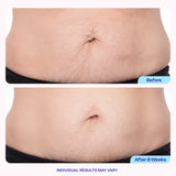 Set de Cremas | Reafirma la piel de tu cara, brazos, abdomen y piernas en 30 días foto 6